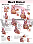 Heart Disease Anatomical Chart